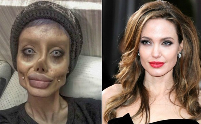 Gone Wrong - Plastic surgery gone wrong porn star edition | Porn Dude â€“ Blog